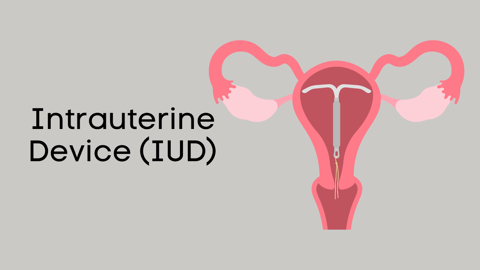 IUD